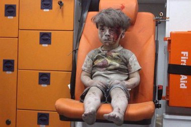 IL BAMBINO FERITO SUL SEDILE ARANCIONE. ALTRA BRAVATA DEI CASCHI BIANCHI