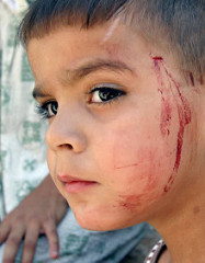 SEPPELLENDO IL RAPPORTO LANCET... E I BAMBINI