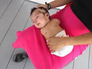 GUERRA CHIMICA: GLI ORRIBILI DIFETTI ALLA NASCITA COLLEGATI AI PESTICIDI