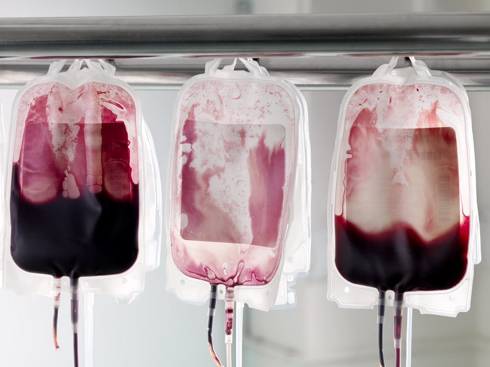 Ambrosia, l’azienda delle trasfusioni di sangue giovane è tornata in attività