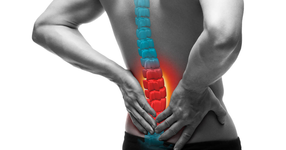 Mal di schiena: può dipendere dall'intestino