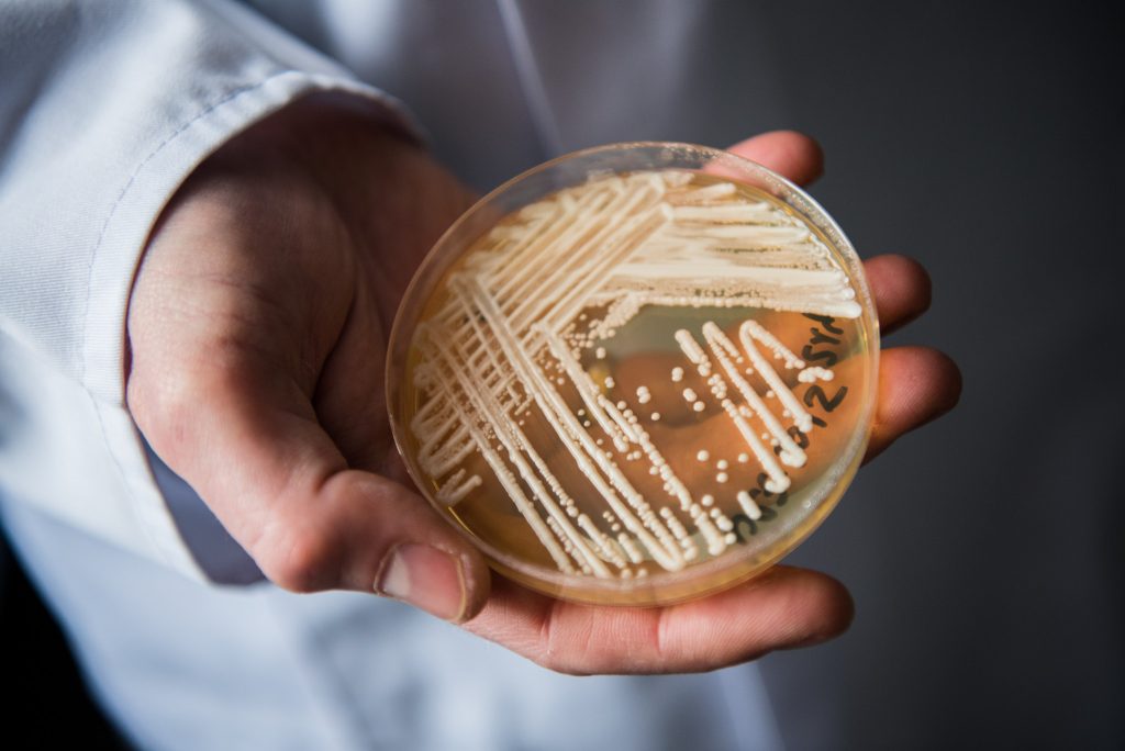 Candida auris, seria minaccia creata dai fungicidi usati per conservare la frutta