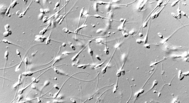 Vaccini Covid e riduzione degli spermatozoi lo studio