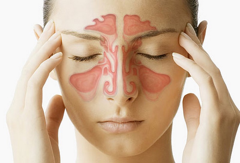 Stop alla sinusite