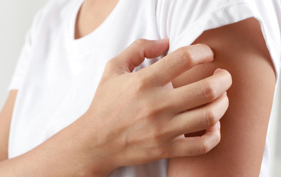 L’attivazione dell’herpes zoster è associata alla vaccinazione COVID