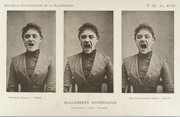 Hysteria!