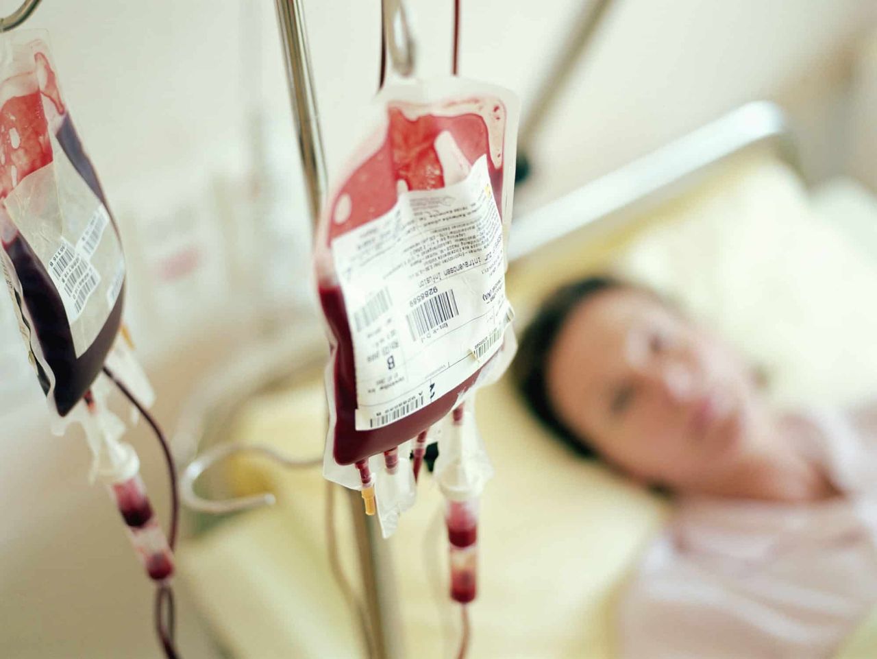 TRASFUSIONE DEDICATA PER I NON VACCINATI: E' FATTIBILE E POSSIBILE!